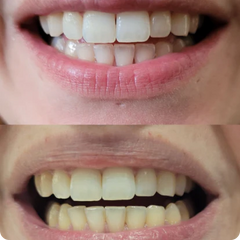 Emily R. testimonial