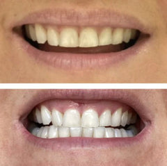 Daniel K. testimonial