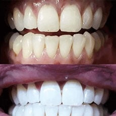 Jacob T. testimonial