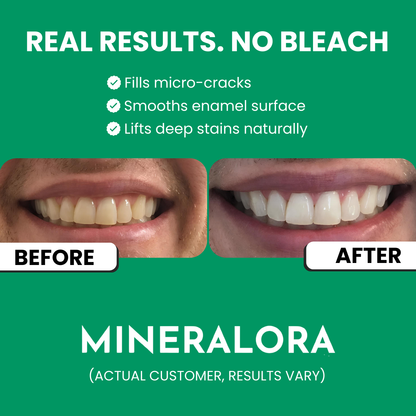 Enamel Repair Toothpaste with 7.5% Hydroxyapatite & Xylitol